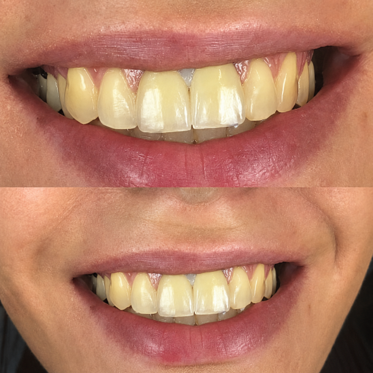 После