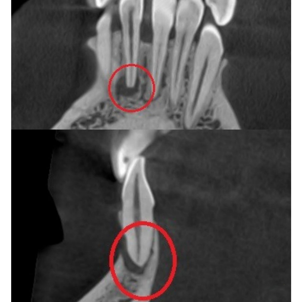 До