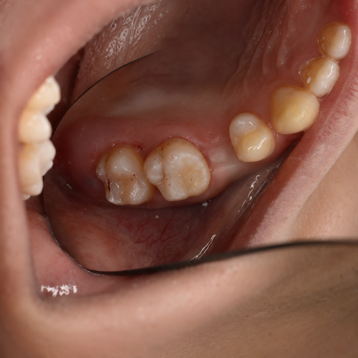 После лечения