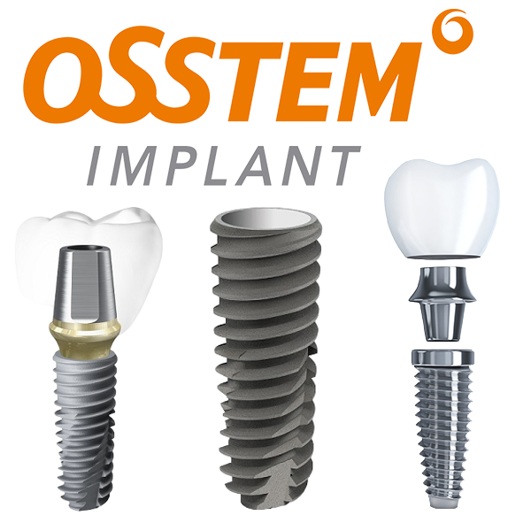 Установка имплантов OSSTEM (ОССТЕМ) под ключ 